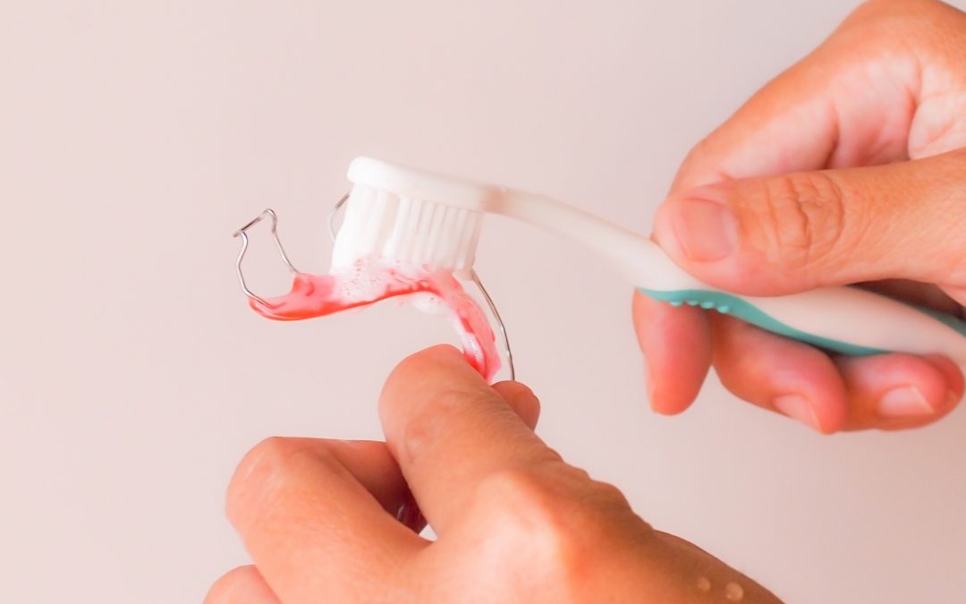 Cleaning Removable Orthodontic Appliances